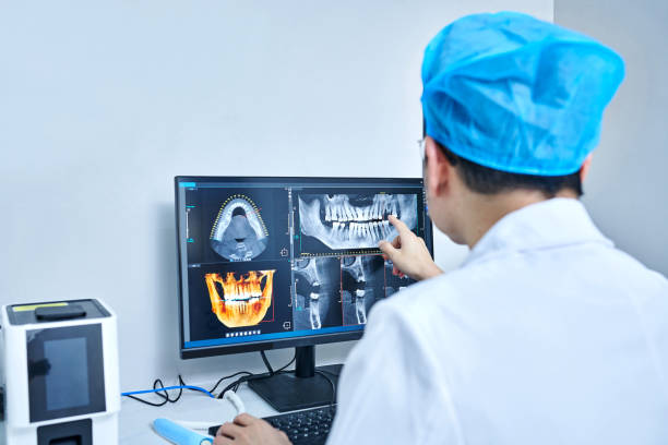 Best Emergency Tooth Extraction in Memphis, TN